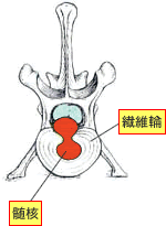 犬の椎間板ヘルニアとは